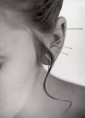 Auriculoterapia